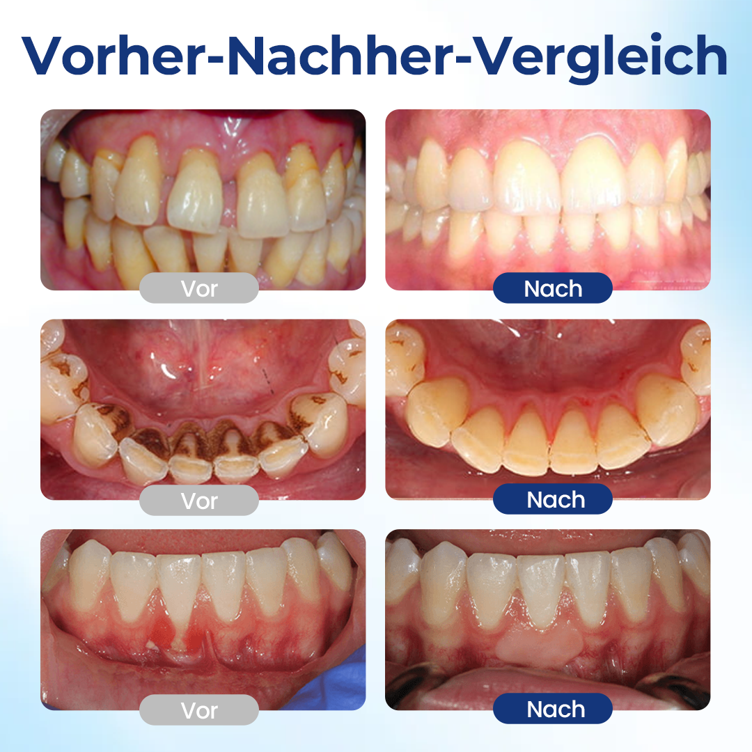 Biancat® | BeeTakt Zahnfleisch-Repair Lösung
