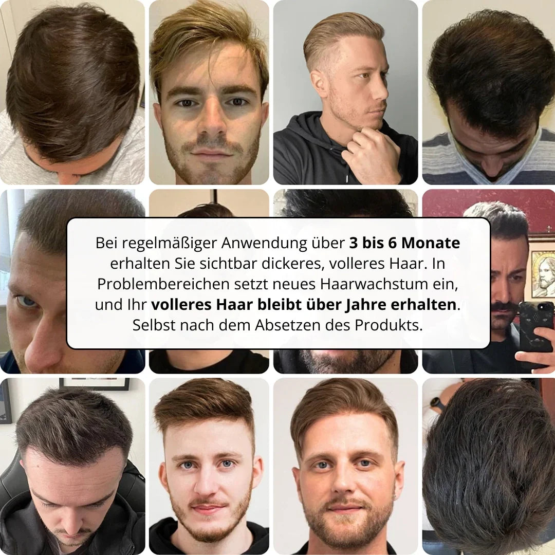 HairViva™ Haarwuchs-System für kräftigeres und dichteres Haar